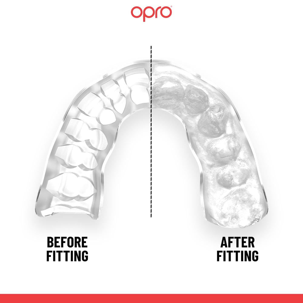 OPRO Instant Custom Self Fit Mouthguard-Opro