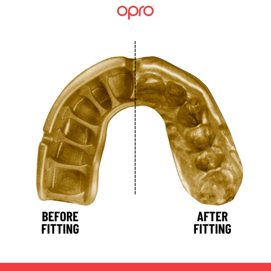 OPRO Self-Fit GEN5 Gold Mouthguard-Opro