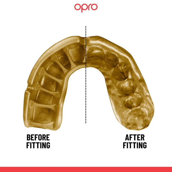 OPRO Self-Fit GEN5 Gold Mouthguard-Opro